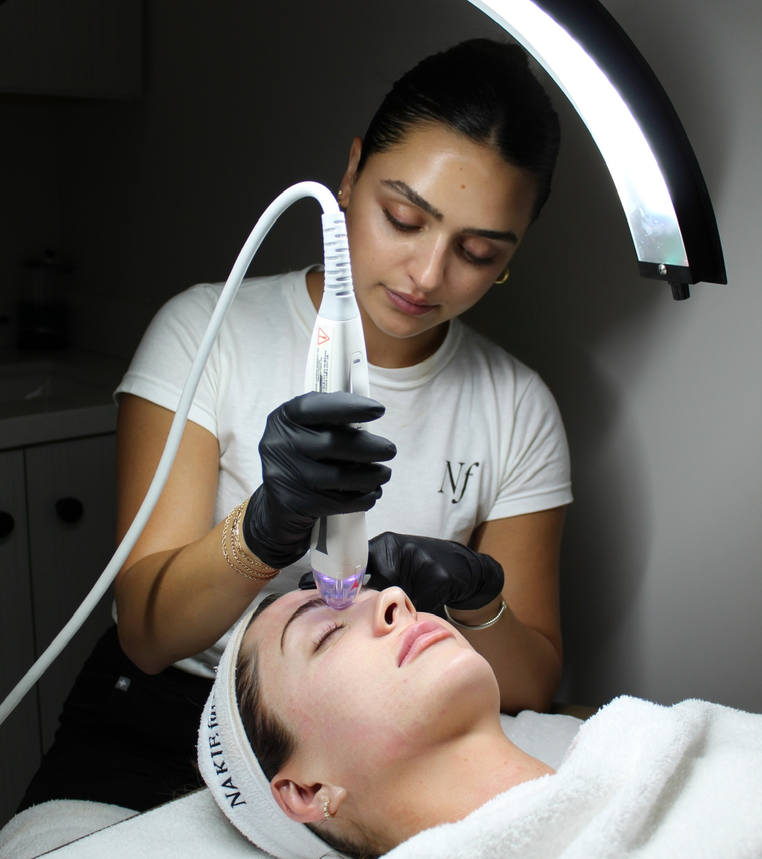 RF Microneedling